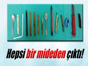 MİDESİNDEN 15 YABANCI CİSİM ÇIKTI